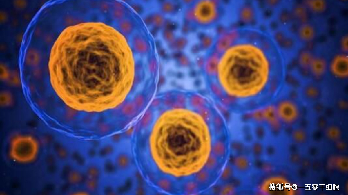 干细胞治疗4类肾病的临床应用前景