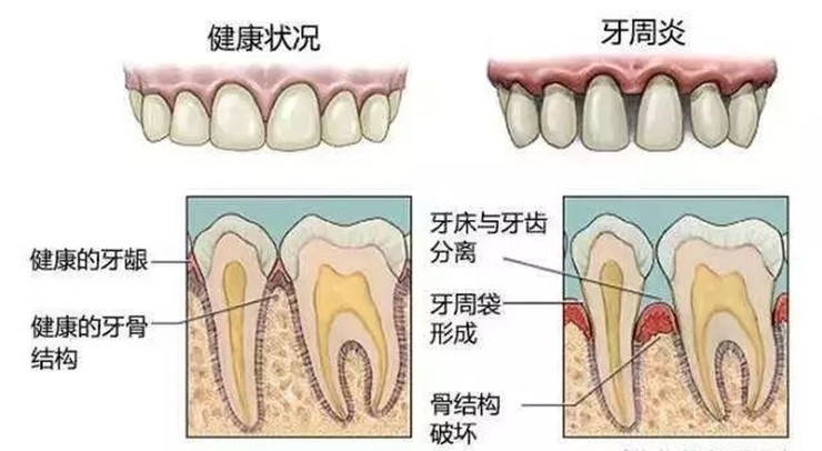 中国干细胞新药防治“老掉牙”临床显奇效，牙齿再生不再是梦