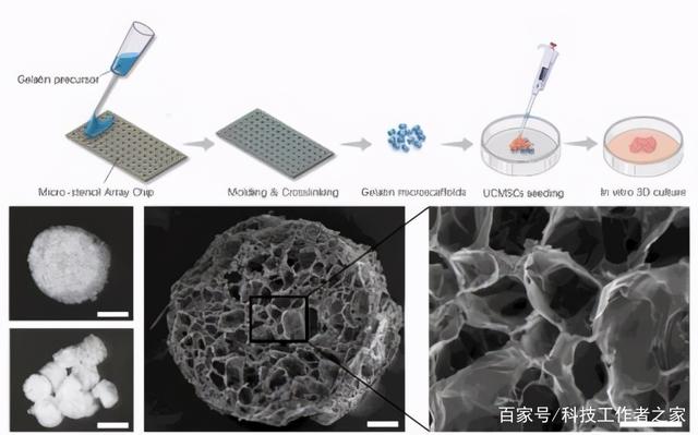 “3D海绵”干细胞疗法或可逆转关节炎