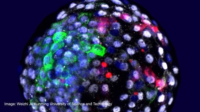科学家将人类干细胞注入猕猴胚胎的实验或为人工培育替代器官铺平道路