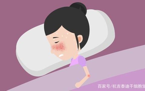 干细胞治疗系统性红斑狼疮主要通过其免疫调节作用