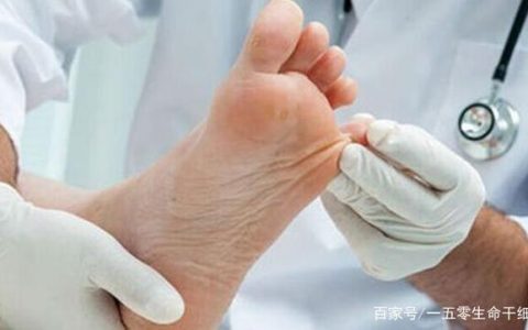 干细胞疗法：为糖尿病足患者带来希望