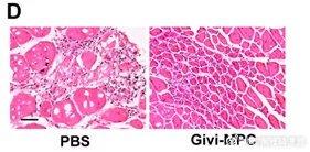 最新研究| 衰老导致肌肉流失！干细胞可以修复