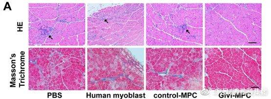 最新研究| 衰老导致肌肉流失！干细胞可以修复