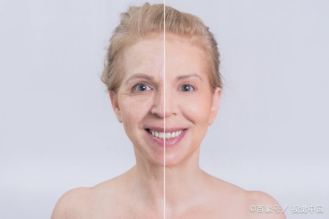 干细胞美容，提高细胞再生！