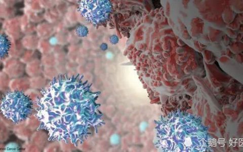 6个问题带你认识，肿瘤浸润淋巴细胞免疫疗法