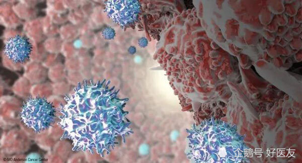6个问题带你认识，肿瘤浸润淋巴细胞免疫疗法