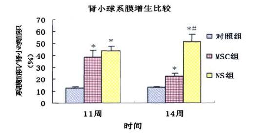 临床探究：干细胞移植将成为IgA肾损伤的重要突破口？