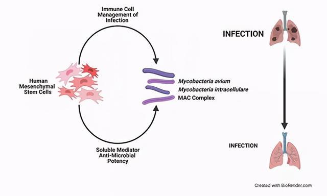 最新研究！间充质干细胞具有明显的抗菌效力，感染性疾病迎新希望