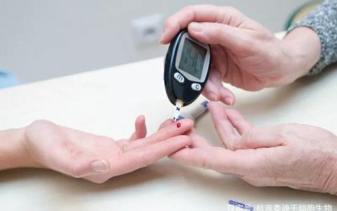 干细胞治疗2型糖尿病的临床案例研究现状！