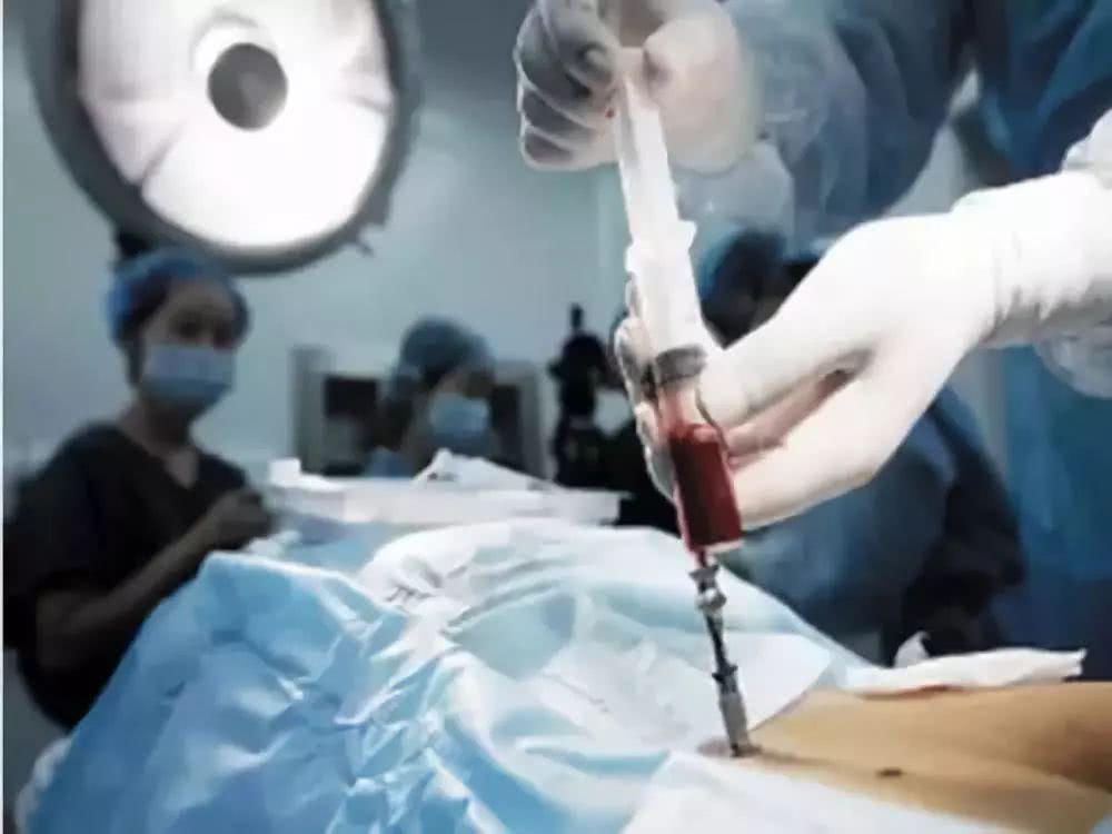 CSCO中国自体造血干细胞移植工作组落地冰城