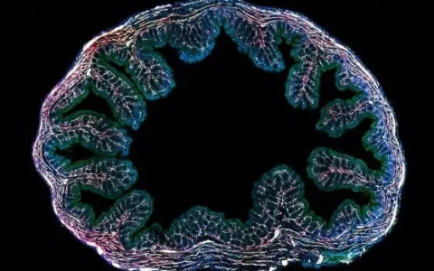 【Nature】连发3篇重磅文章：肠道中的癌症干细胞对邻近细胞产生不良影响