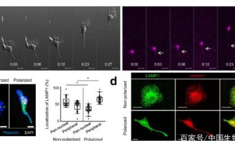 日本研究人员Nature子刊揭示免疫细胞迁移的新分子机制