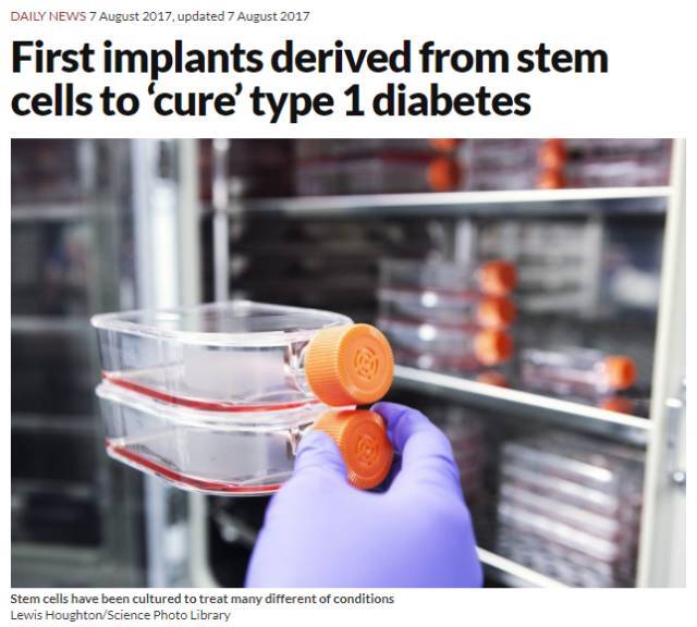福音！干细胞“根治”糖尿病有了新的临床进展