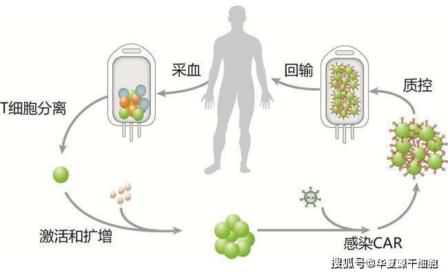 回输、疫苗、药物，抗癌的免疫细胞疗法，你知道多少种？