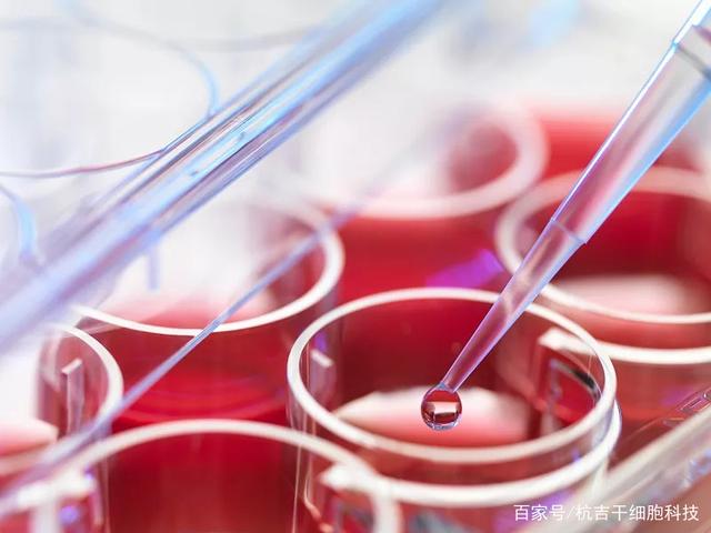 65例干细胞移植改善肝硬化的疗效及安全性评估