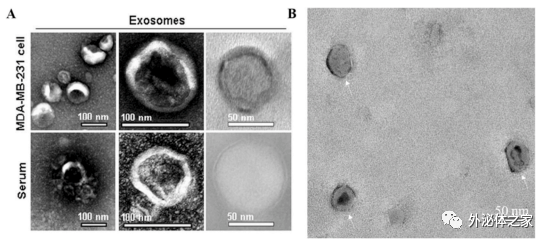 【综述】国家纳米科学中心：牛奶外泌体作为口服给药系统的前景探讨
