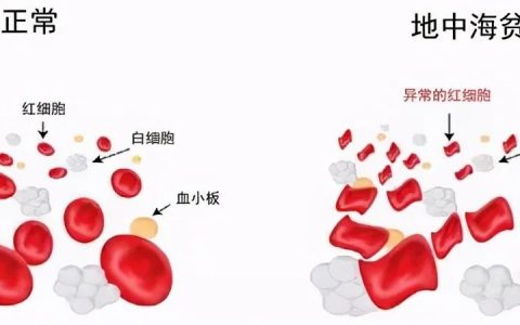 【招募】广西医科大学第一附属医院|经γ珠蛋白重激活的自体造血干细胞移植治疗重型β地中海贫血安全性及有效性的临床研究