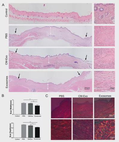 干细胞外泌体在皮肤病领域的应用：伤口愈合、抗衰、毛发再生……