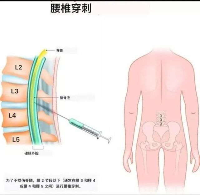 干细胞治疗离我们远吗？