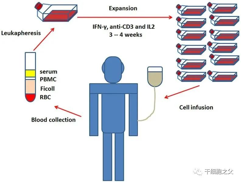 除了120万一针的CAR-T，还有两大抗癌法宝CIK、NK，你分得清吗？