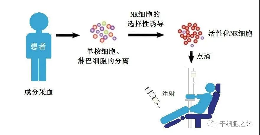 除了120万一针的CAR-T，还有两大抗癌法宝CIK、NK，你分得清吗？