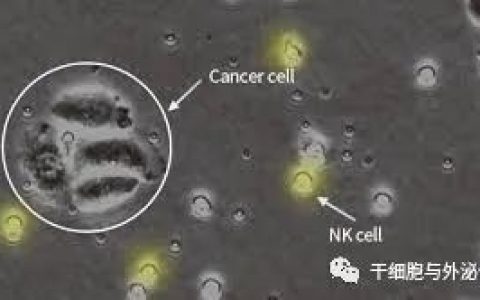 NK细胞在皮肤病治疗中的价值
