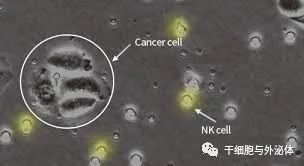 NK细胞在皮肤病治疗中的价值
