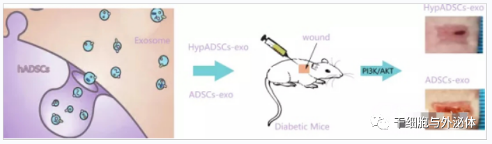 哈医大二院整形美容外科通过外泌体促进糖尿病伤口愈合研究取得突破进展