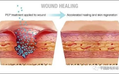 梅奥诊所：外泌体冻干粉用于促进伤口愈合和皮肤修复再生