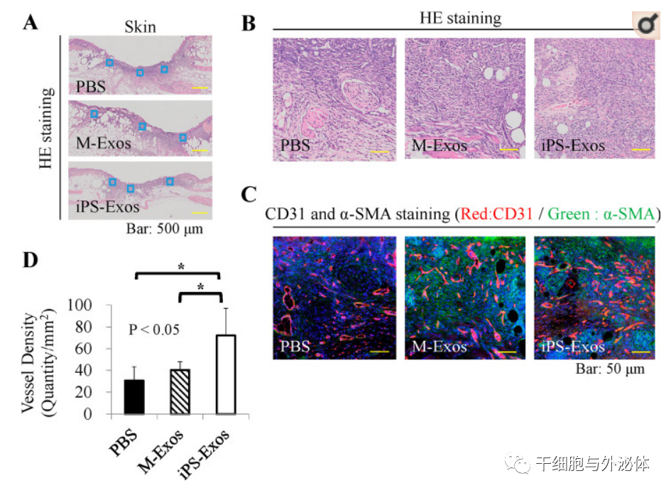 诱导多能干细胞衍生外泌体对皮肤再生修复能力更强