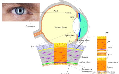 细胞重建角膜恢复视力：HCEnC产品介绍