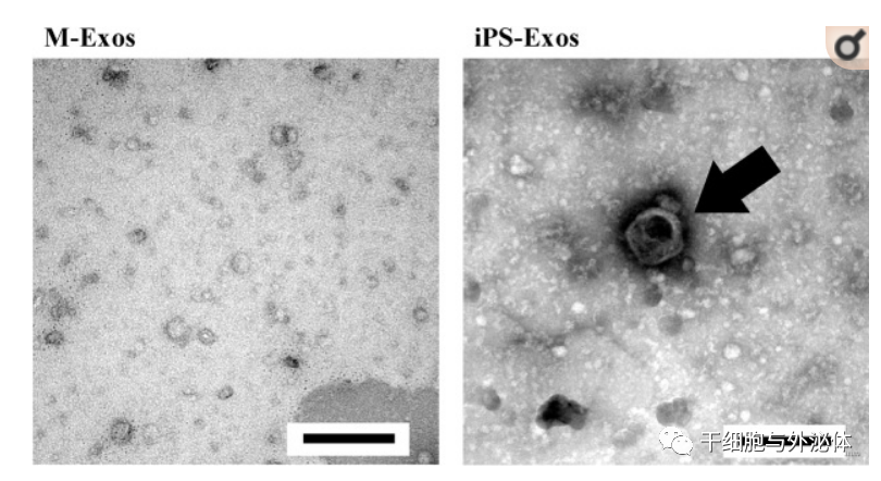 诱导多能干细胞衍生外泌体对皮肤再生修复能力更强