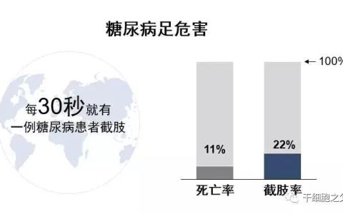 13项临床试验，582例患者，评估干细胞移植治疗糖尿病足的疗效及安全性!