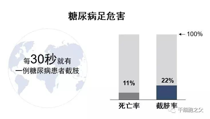 13项临床试验，582例患者，评估干细胞移植治疗糖尿病足的疗效及安全性!