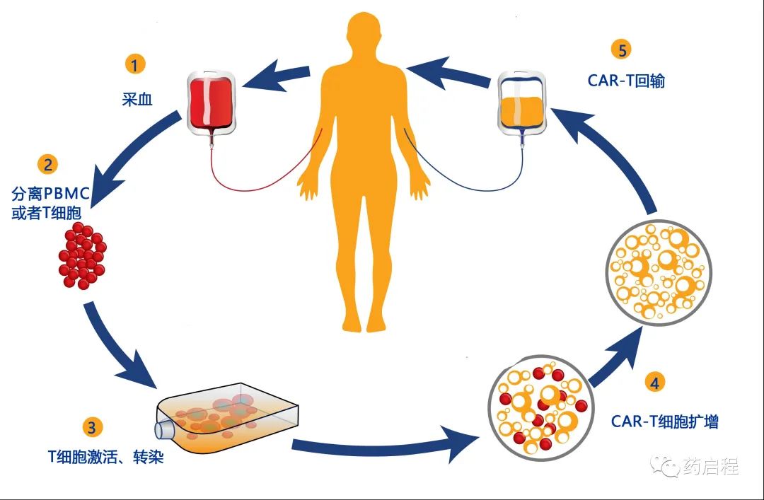 CAR-T细胞的制造