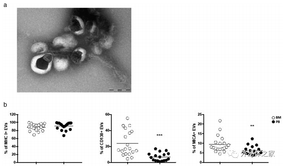 JEV：细胞外囊泡对NK细胞功能的影响——癌症免疫监视中的双重作用