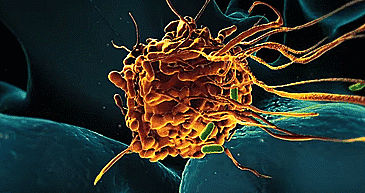 告别化疗之苦，细胞免疫疗法让直肠癌患者重获新生！
