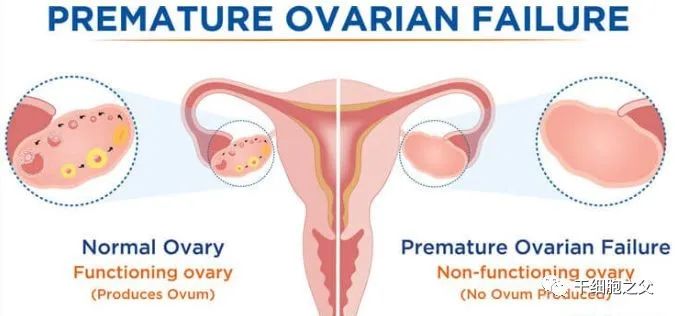 卵巢老1岁，女人老10岁，干细胞如何化解当下女性卵巢危机？
