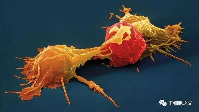 NK细胞异军突起，有望对多种实体瘤实现精准打击！