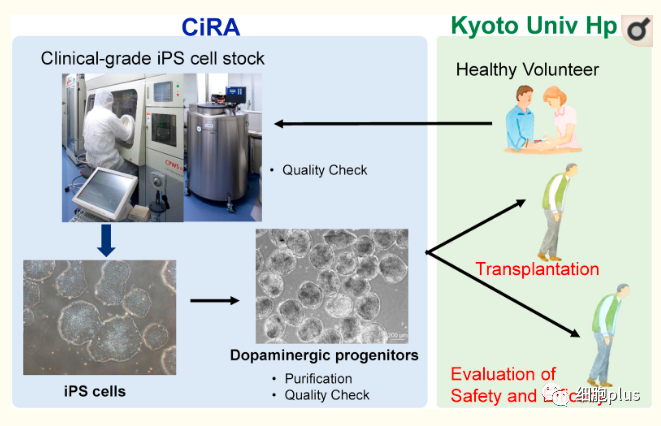 解析 | 首例IPS来源的神经细胞治疗脊髓损伤 三到五年才能见分晓