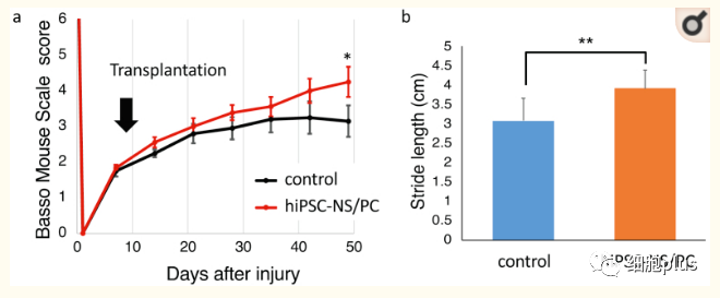解析 | 首例IPS来源的神经细胞治疗脊髓损伤 三到五年才能见分晓