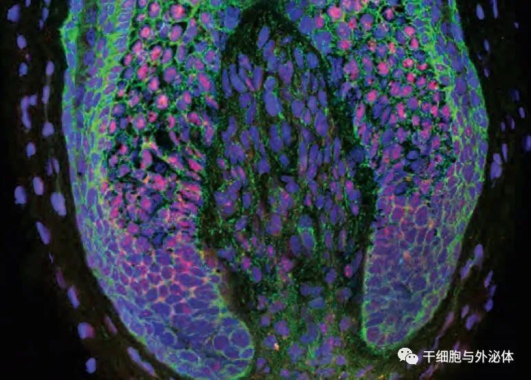 治疗脱发 | 神经祖细胞衍生的纳米囊泡通过 miR-100 促进毛囊生长