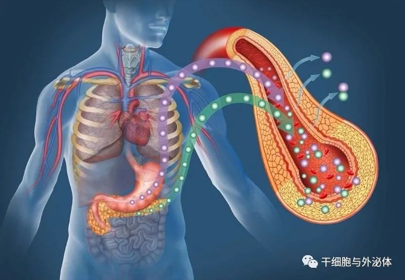 间充质干细胞治疗2 型糖尿病的临床研究现状