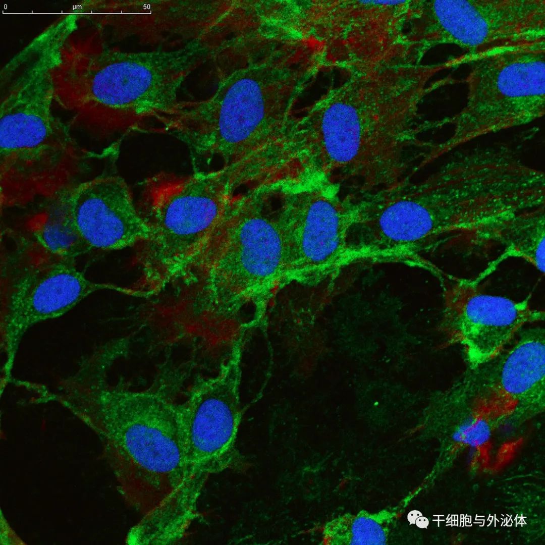 Univercells 和 RoosterBio 合作进行外泌体大规模制造生产