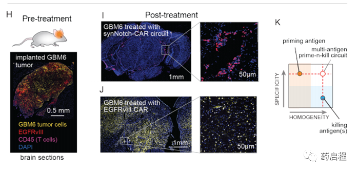 多抗原识别回路克服了胶质母细胞瘤T细胞治疗中的挑战