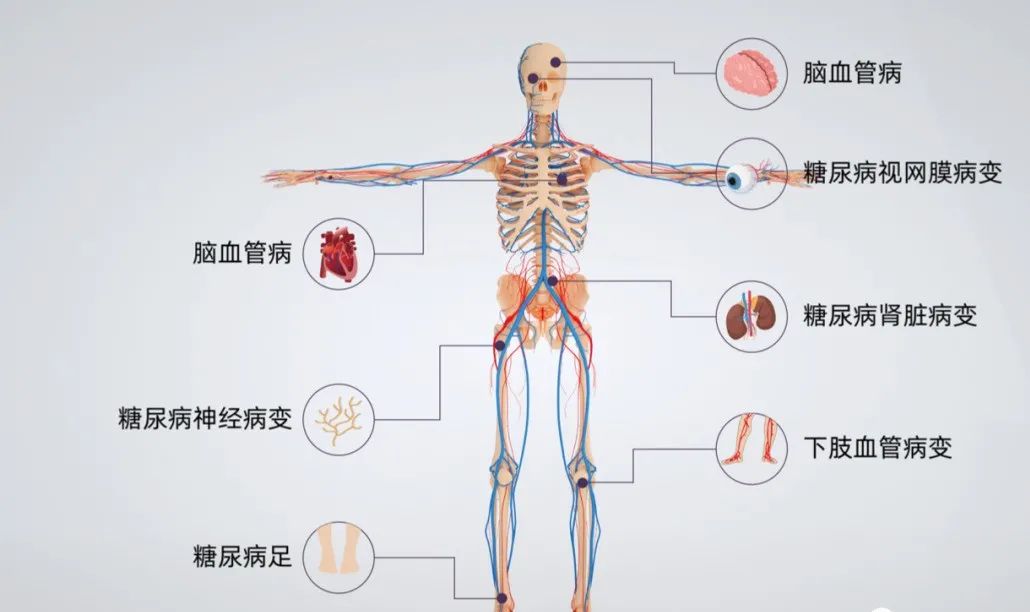 9项临床试验、227名患者数据证实：间充质干细胞治疗显著改善II型糖尿病多项指标