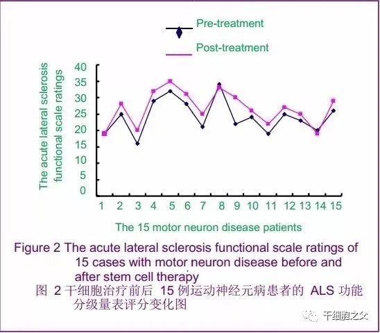 干细胞疗法给神经变性疾病带来无限应用潜力