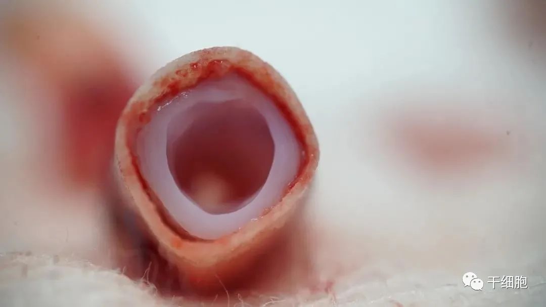 最新干细胞临床研究备案获批！我国首个干细胞3D生物打印血管临床研究即将在华西医院开展