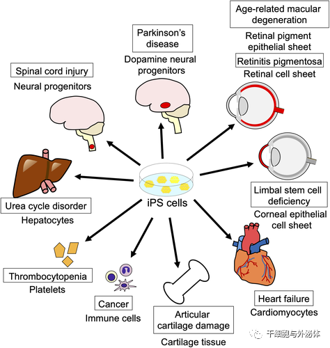 聚焦日本 | iPS细胞临床应用现状及未来方向